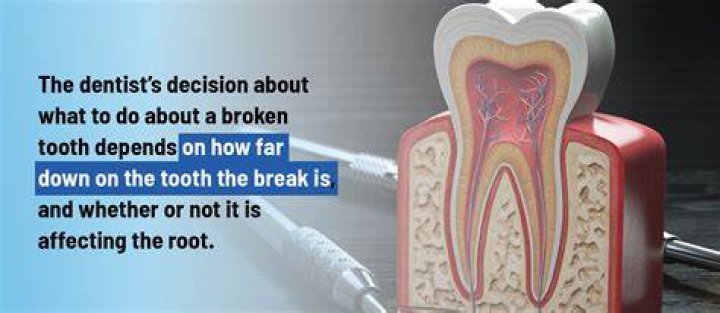 Can a punch break a tooth?