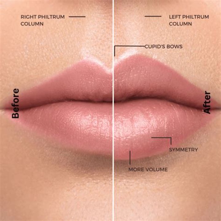What are M lips?